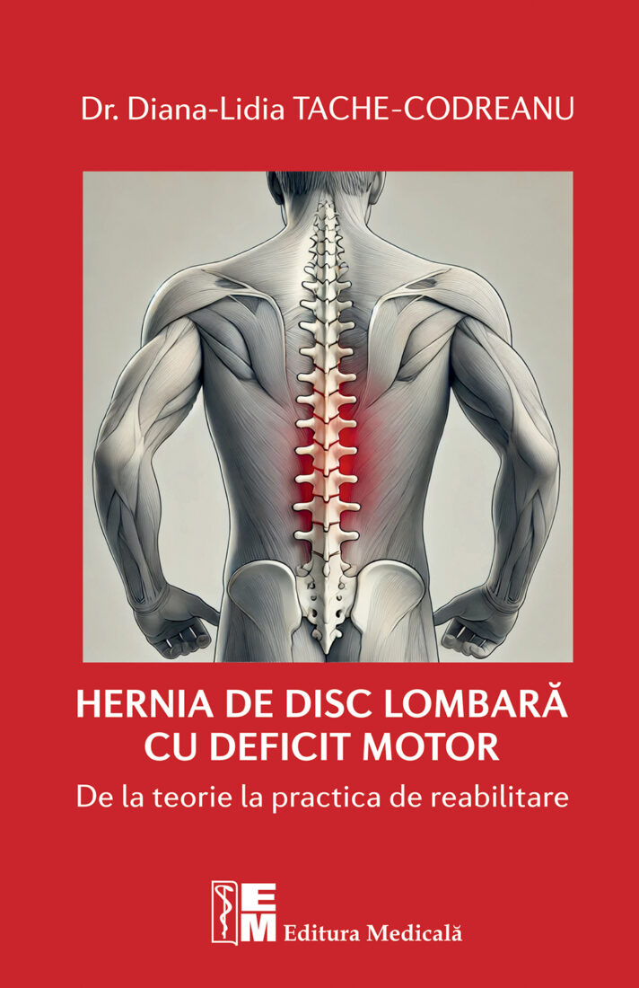 Hernia de disc lombară cu deficit motor. De la teorie la practica de reabilitare